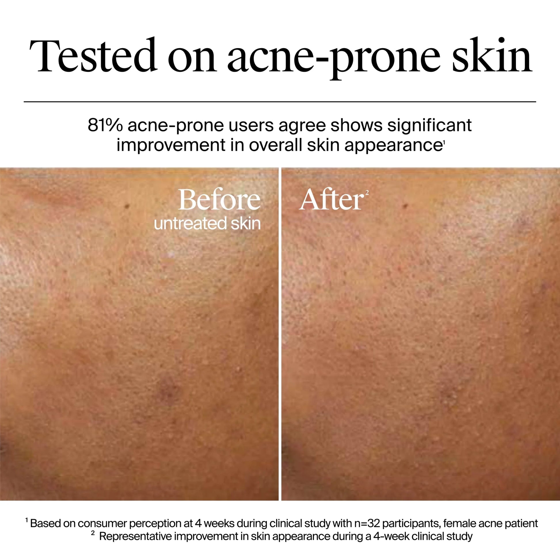 Hydro Boost Hyaluronic Acid Gel Cream, Travel Size, 0.5 Fl. Oz